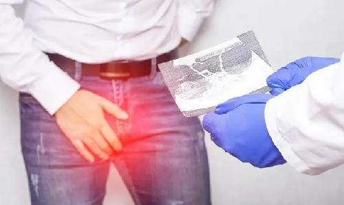 男性在什么情况下需要生殖整形