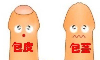阳江包皮过长影响性生活怎么办