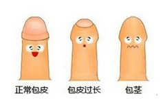 包皮给男性带来什么危害
