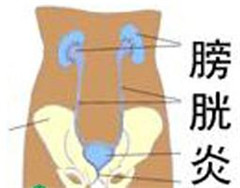 阳江医治膀胱炎哪家比较好