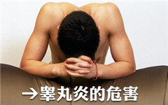 阳江男性睾丸炎的传染方法有哪些