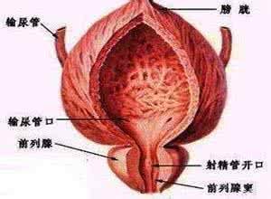 前列腺炎应该怎么预防呢?